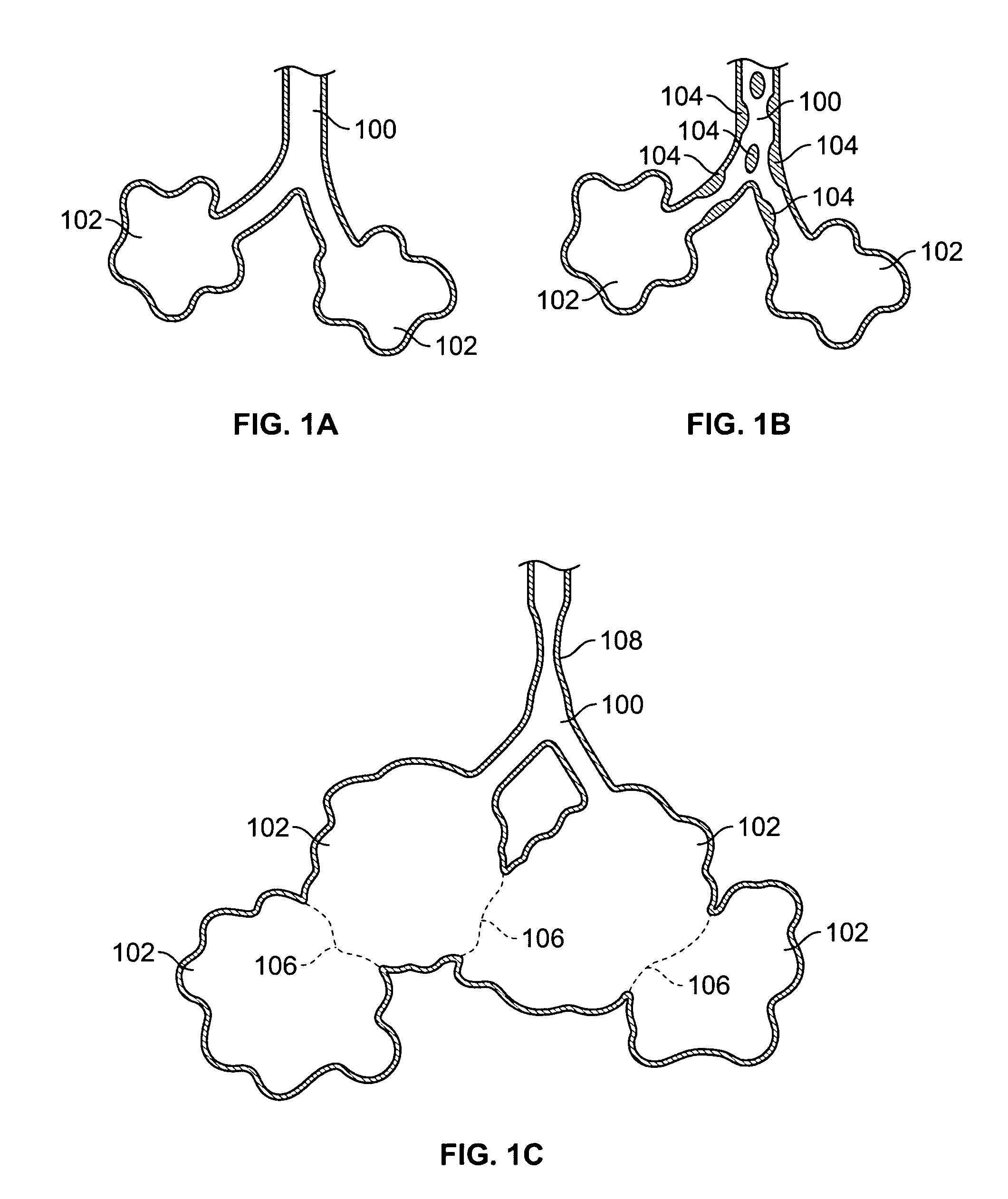 Methods and devices for maintaining surgically created channels in a body organ