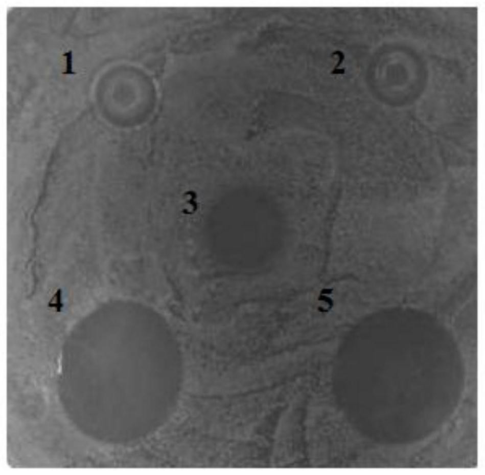 A visual antimicrobial peptide fusion protein and its preparation method and application