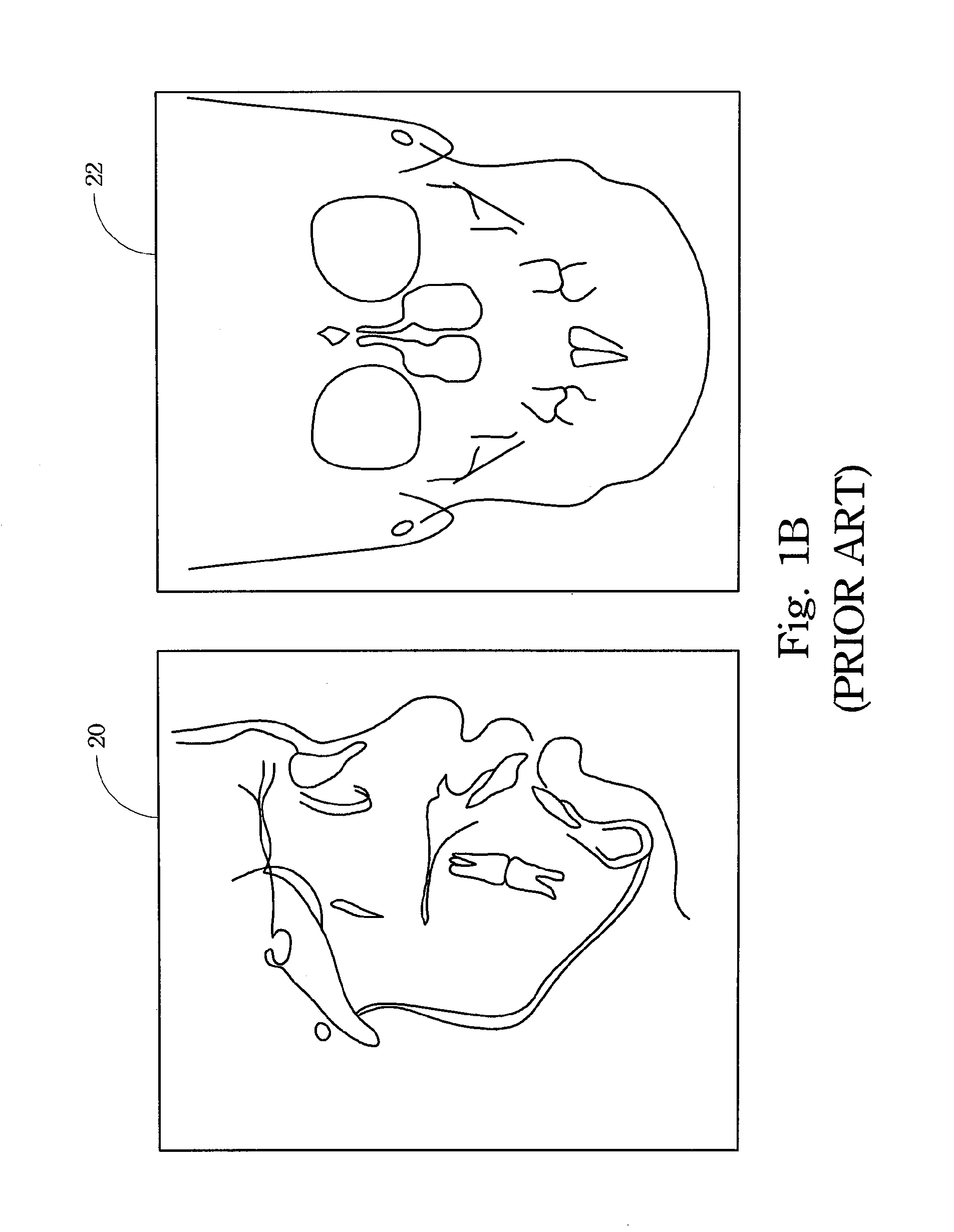 Cephalogram image analysis method