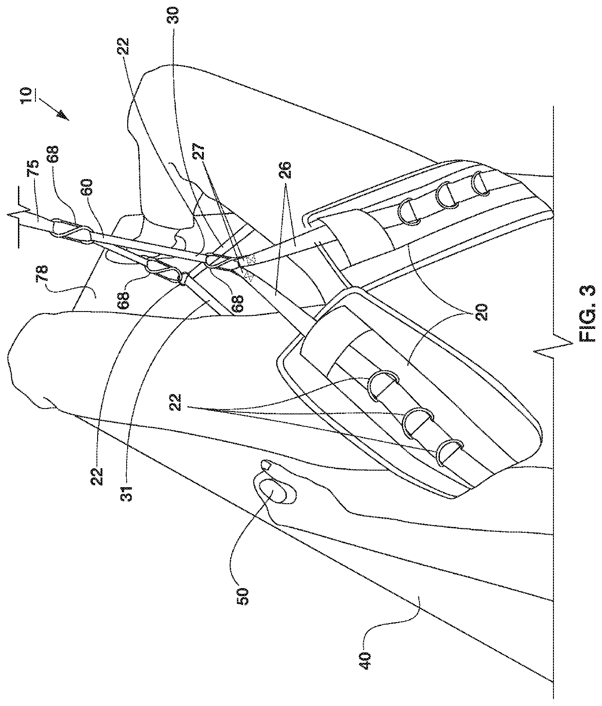 Devices and methods for restoring spinal movement and function