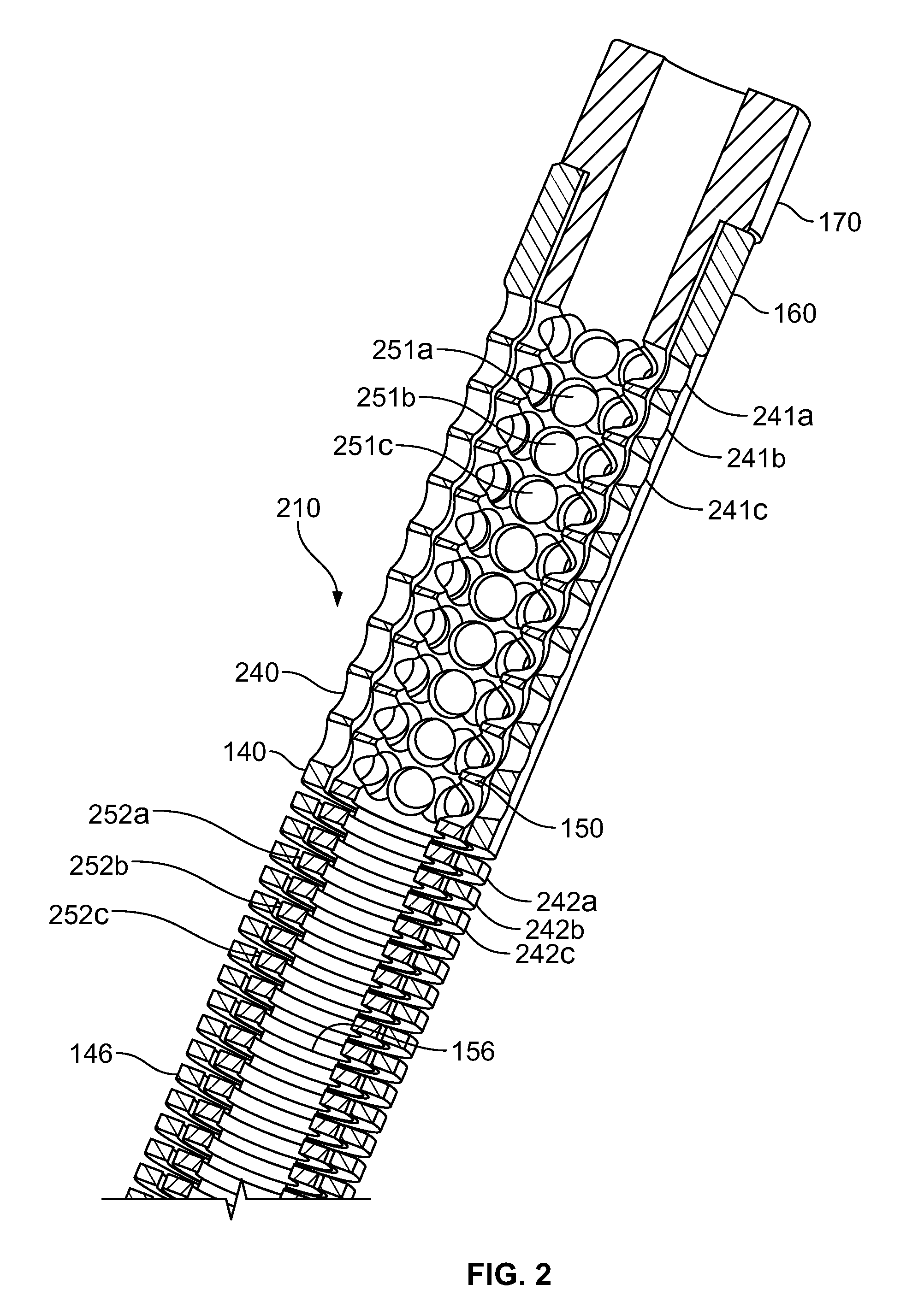 Rotary-rigid orthopaedic rod