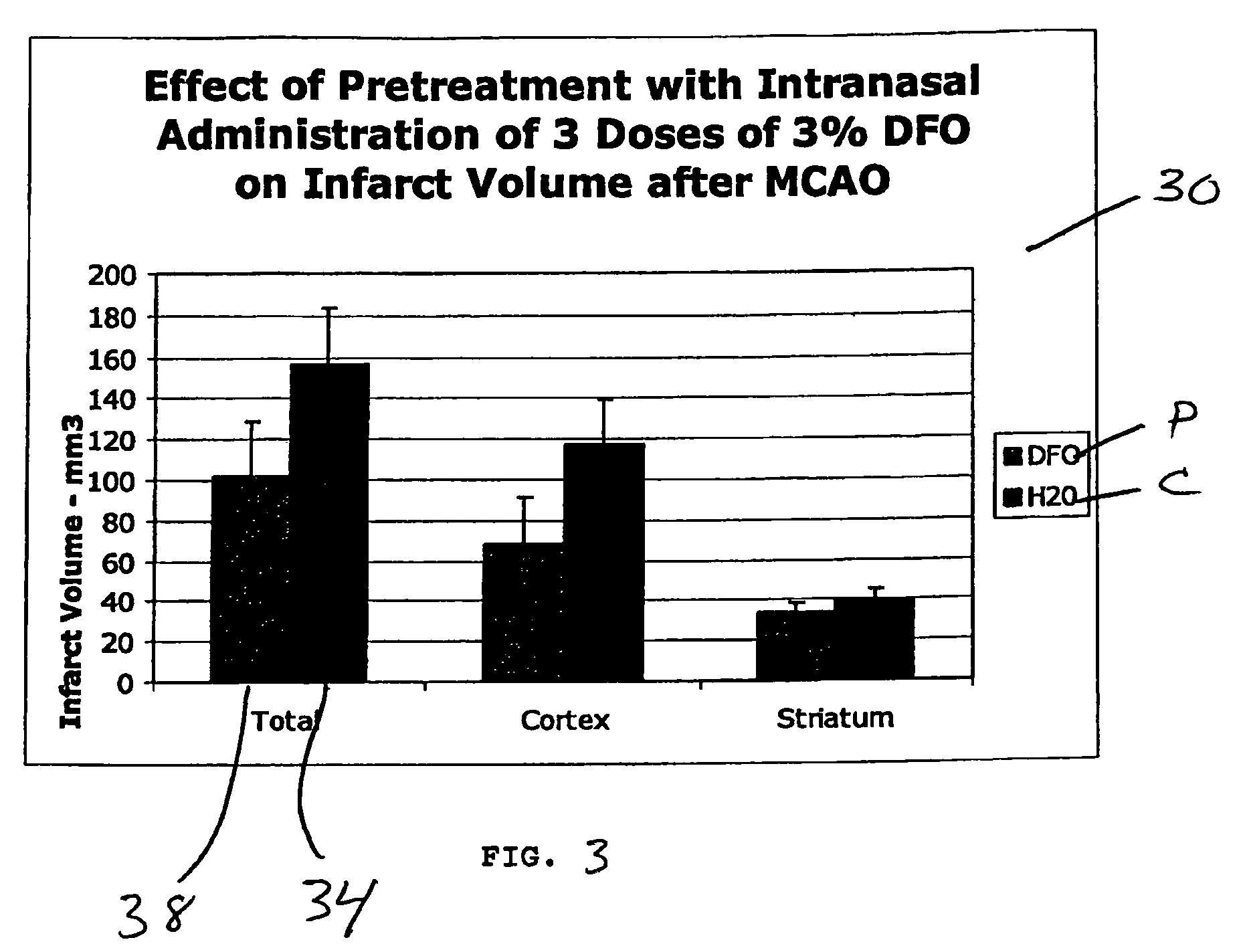 Method of treating Alzheimer's disease comprising administering deferoxamine (DFO) to the upper one-third of the nasal cavity