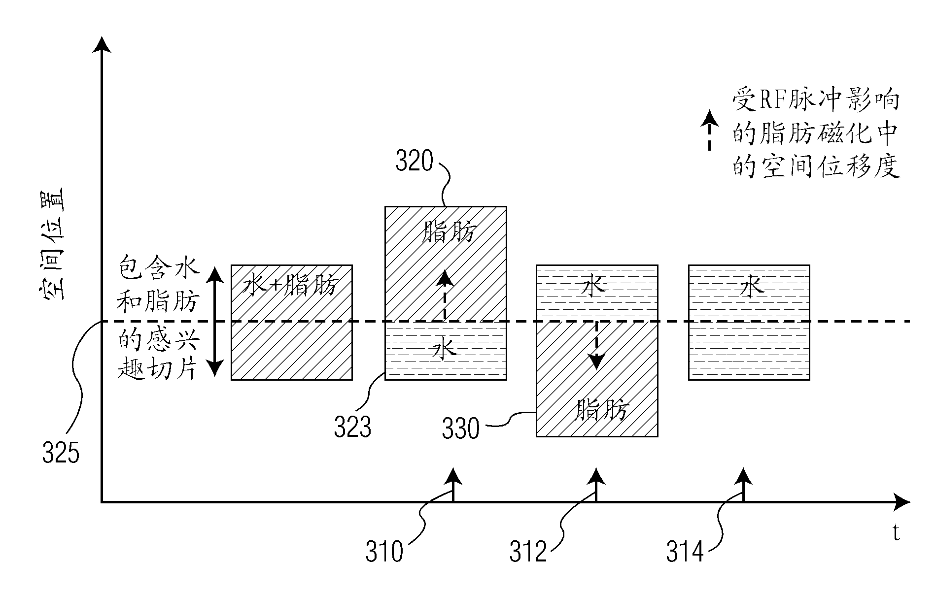 System for fat suppression in obtaining of MR image