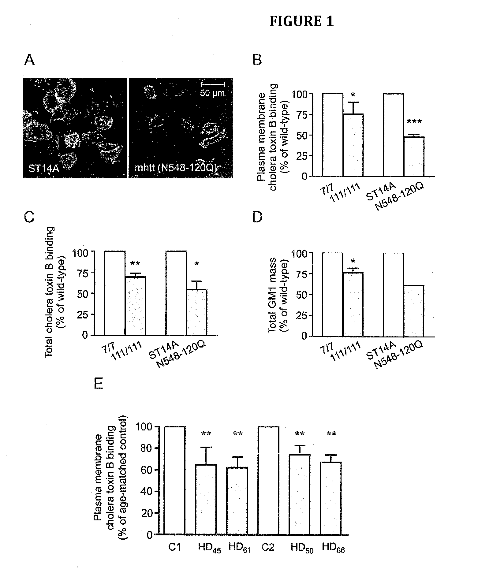 Neuroprotective ganglioside compositions for use in treating or diagnosing huntington's disease