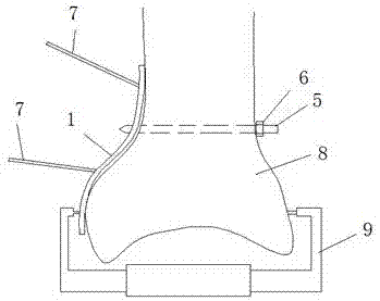 Posterior malleolus dissection and locking steel plate applicable to minimally invasive surgery