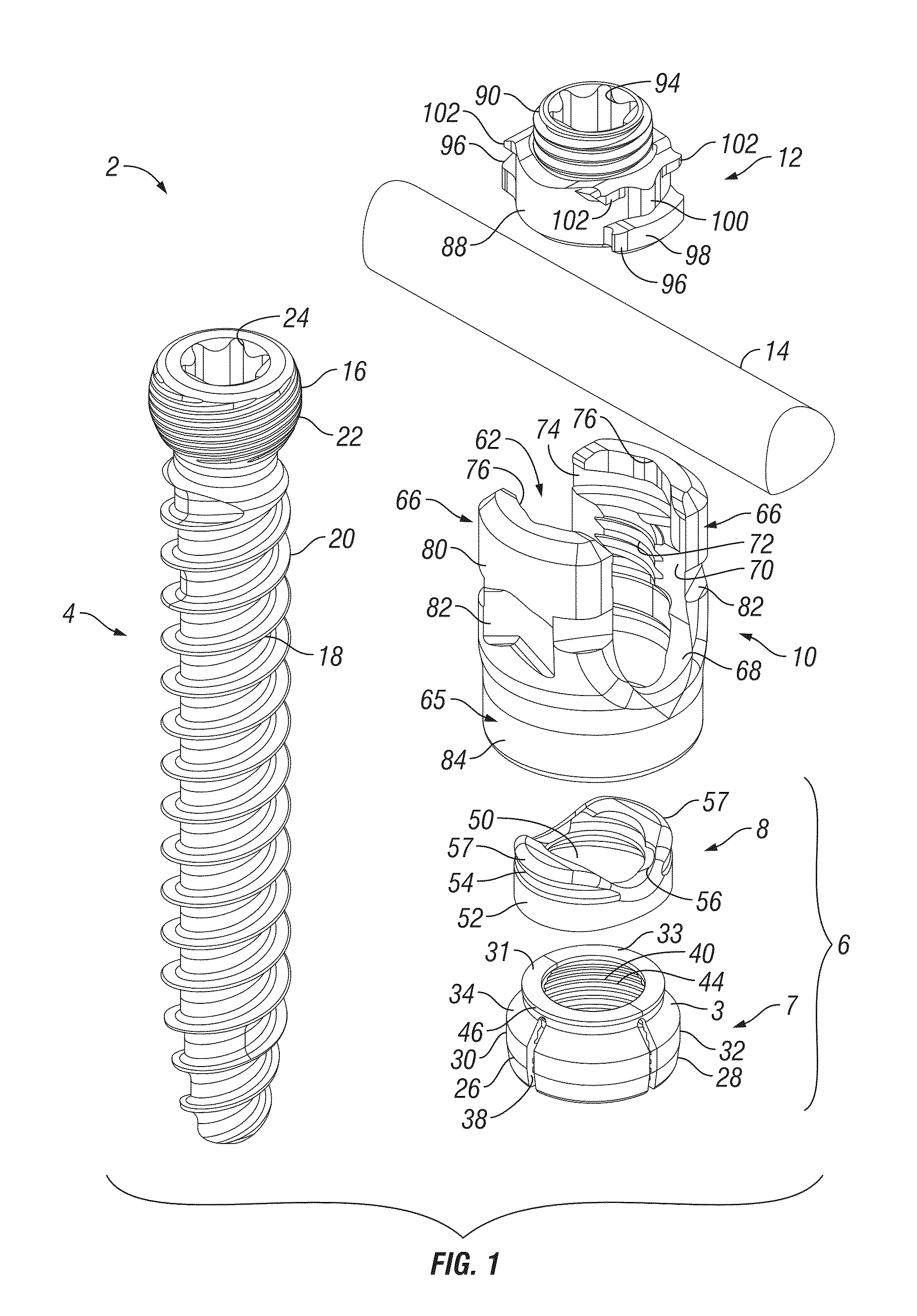 Orthopedic fixation devices and methods of installation thereof