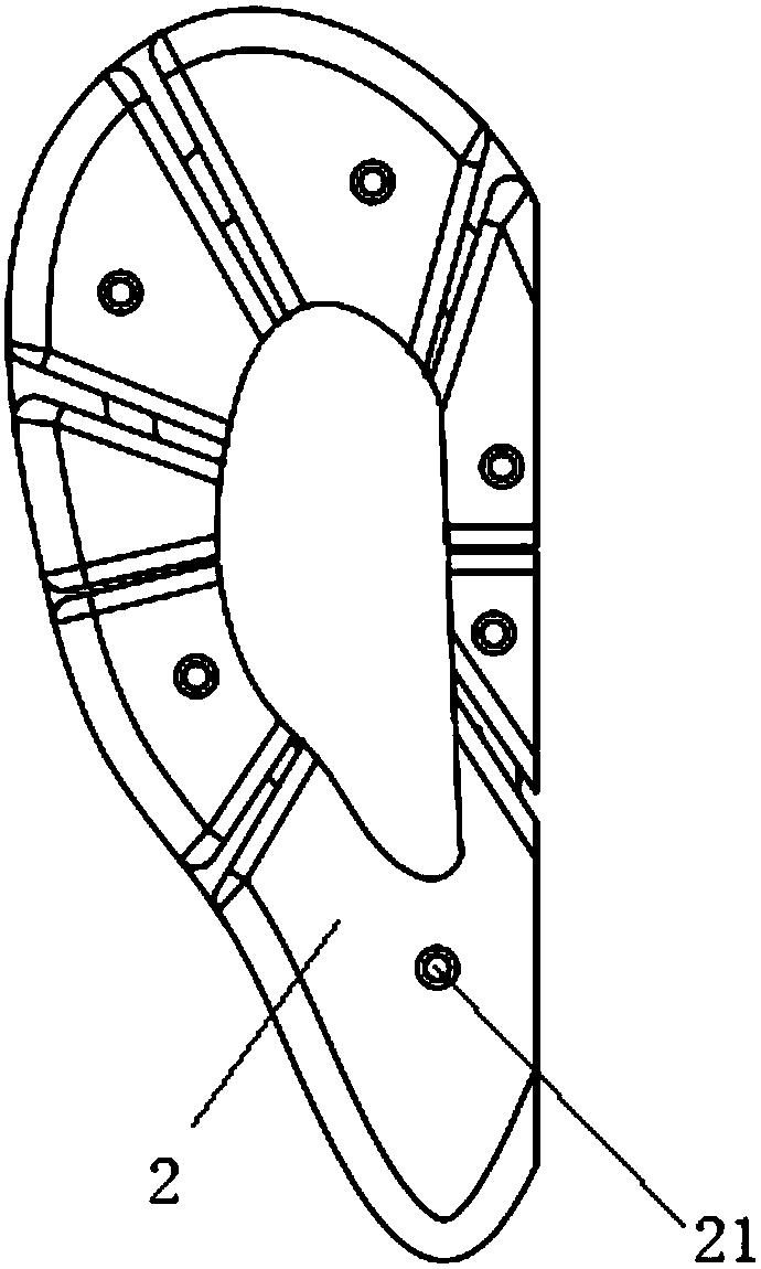 Pressure device for treating keloids of outer auricles