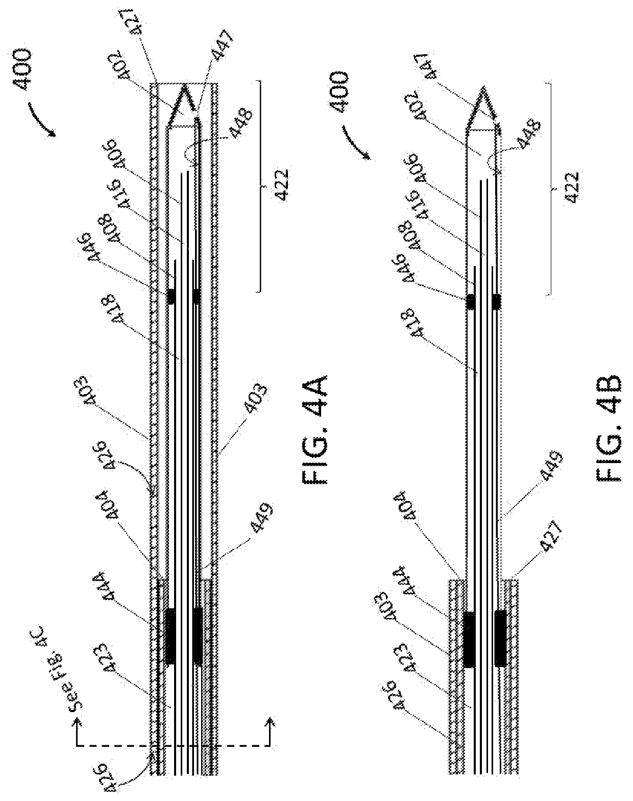 Endoscopic cryoablation catheter