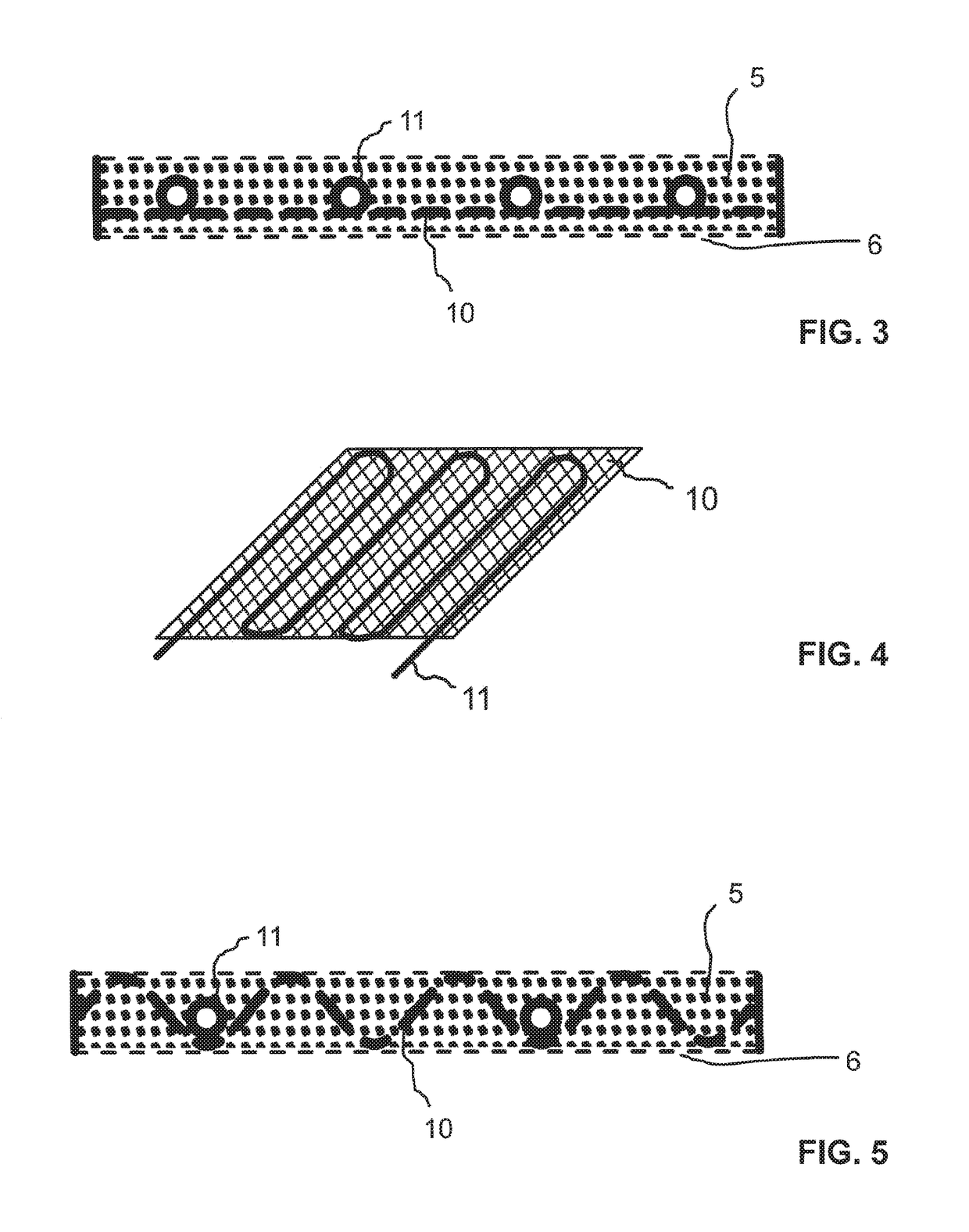 Low-pressure drop structure of particle adsorbent bed for adsorption gas separation process