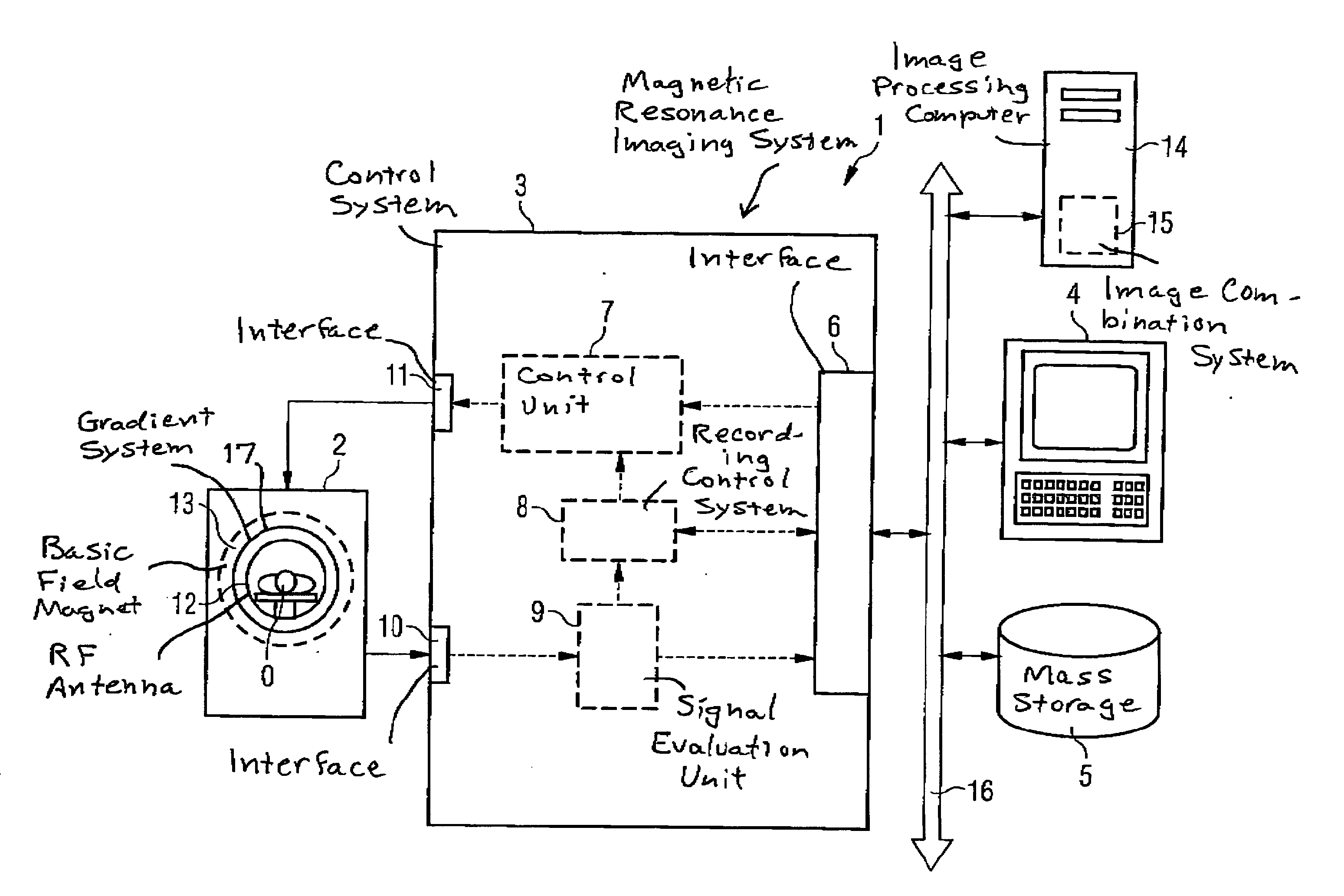 Method and magnetic resonance imaging apparatus for compensating contrast inhomogeneities in magnetic resonance images