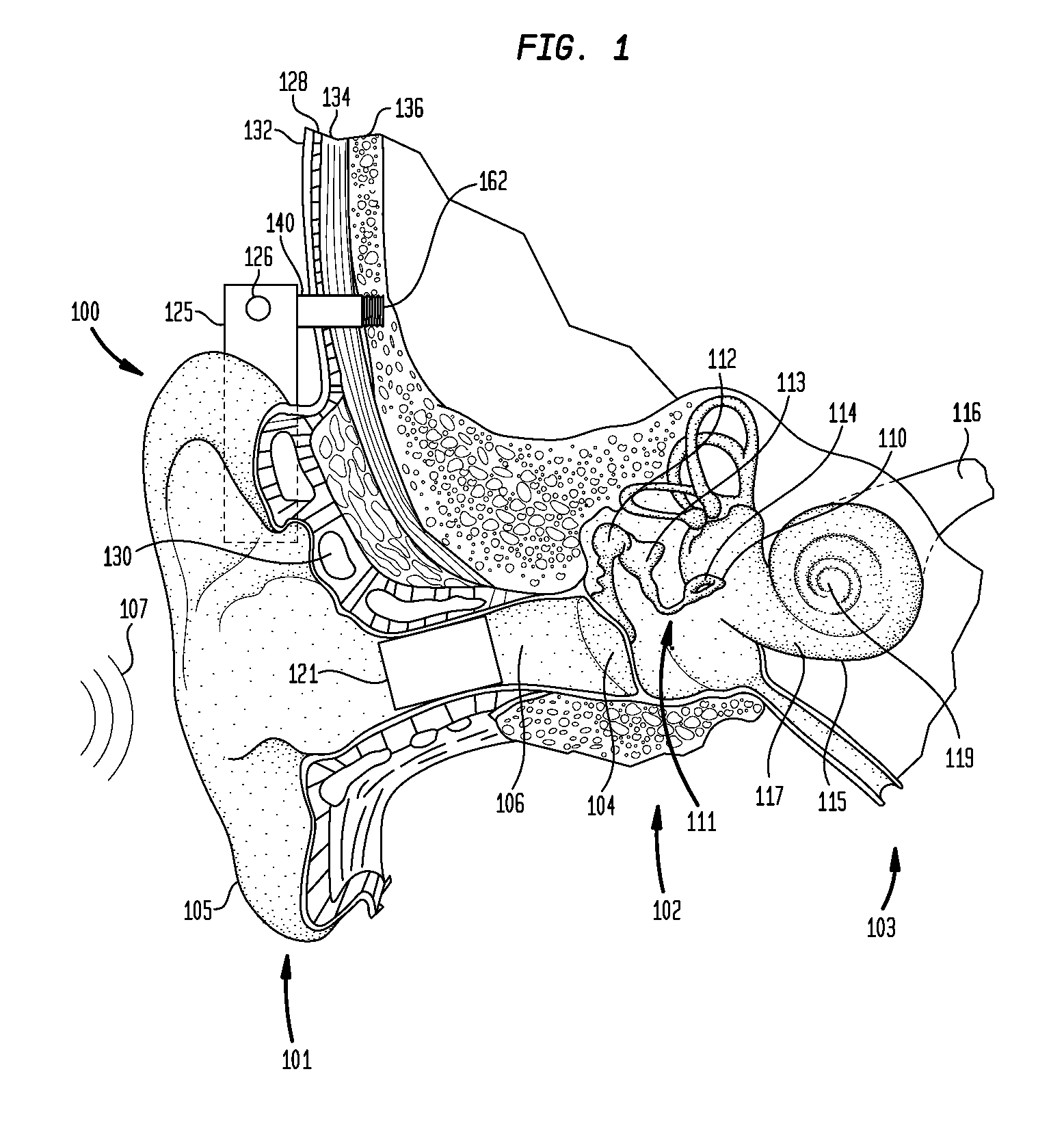 Multi-mode hearing prosthesis