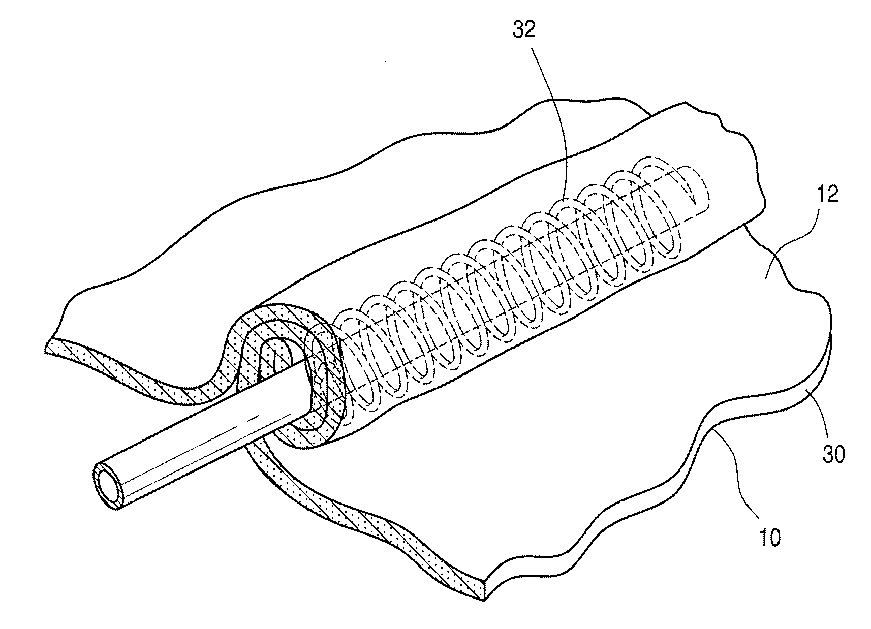 Method of rolling stomach tissue so as to maximize the contact surface area of a fold