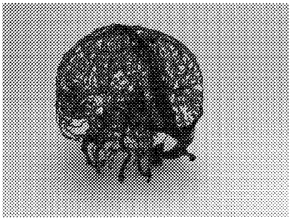 Virtual reality based preoperative auxiliary planning device