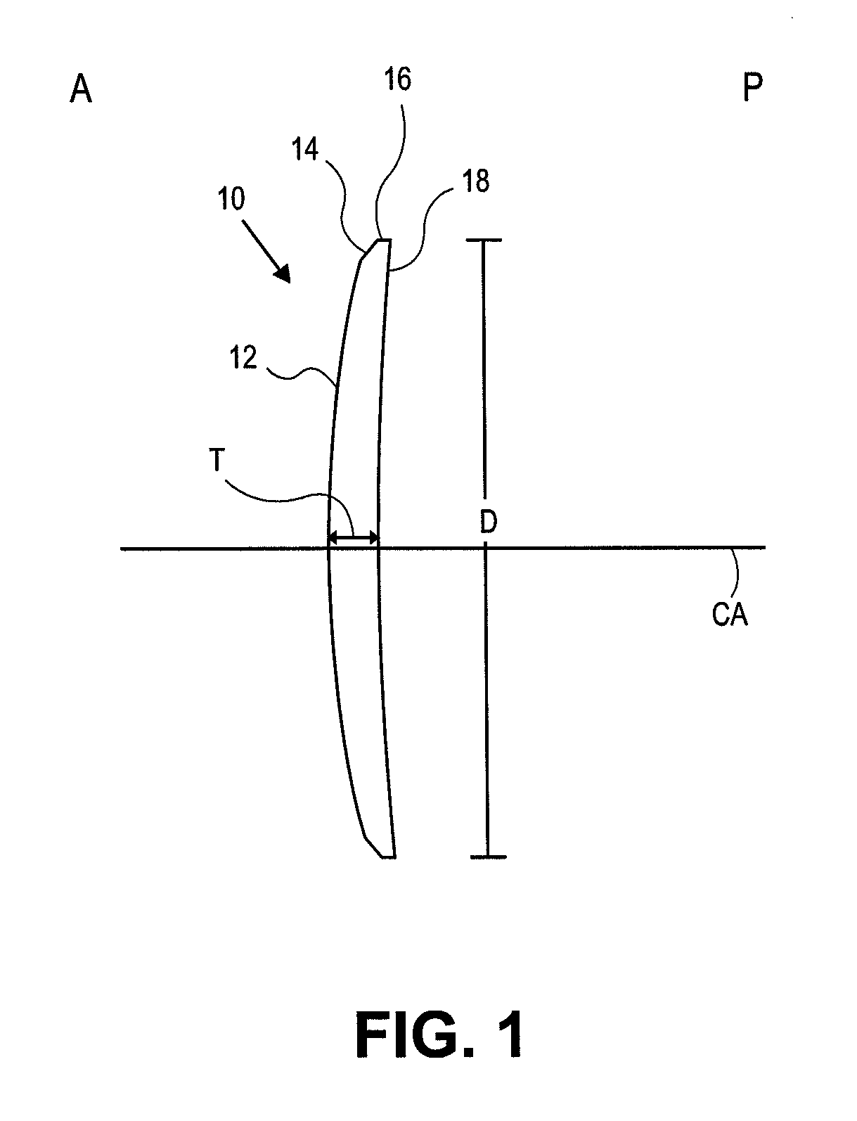 Corneal inlay design and methods of correcting vision