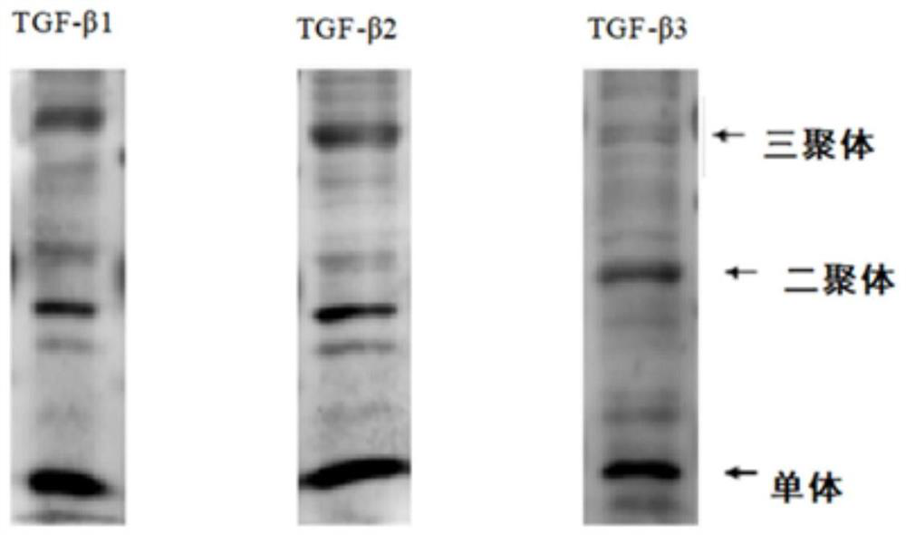 A chimeric antigen receptor and its modified immune cells and the application of the immune cells in the treatment of advanced pancreatic cancer