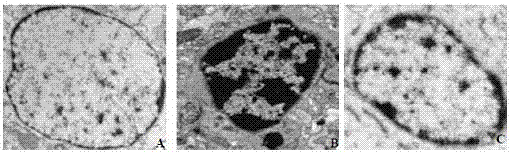 Application of butylphthalide or its derivatives in preparation of drugs for treating radiation-induced brain injury