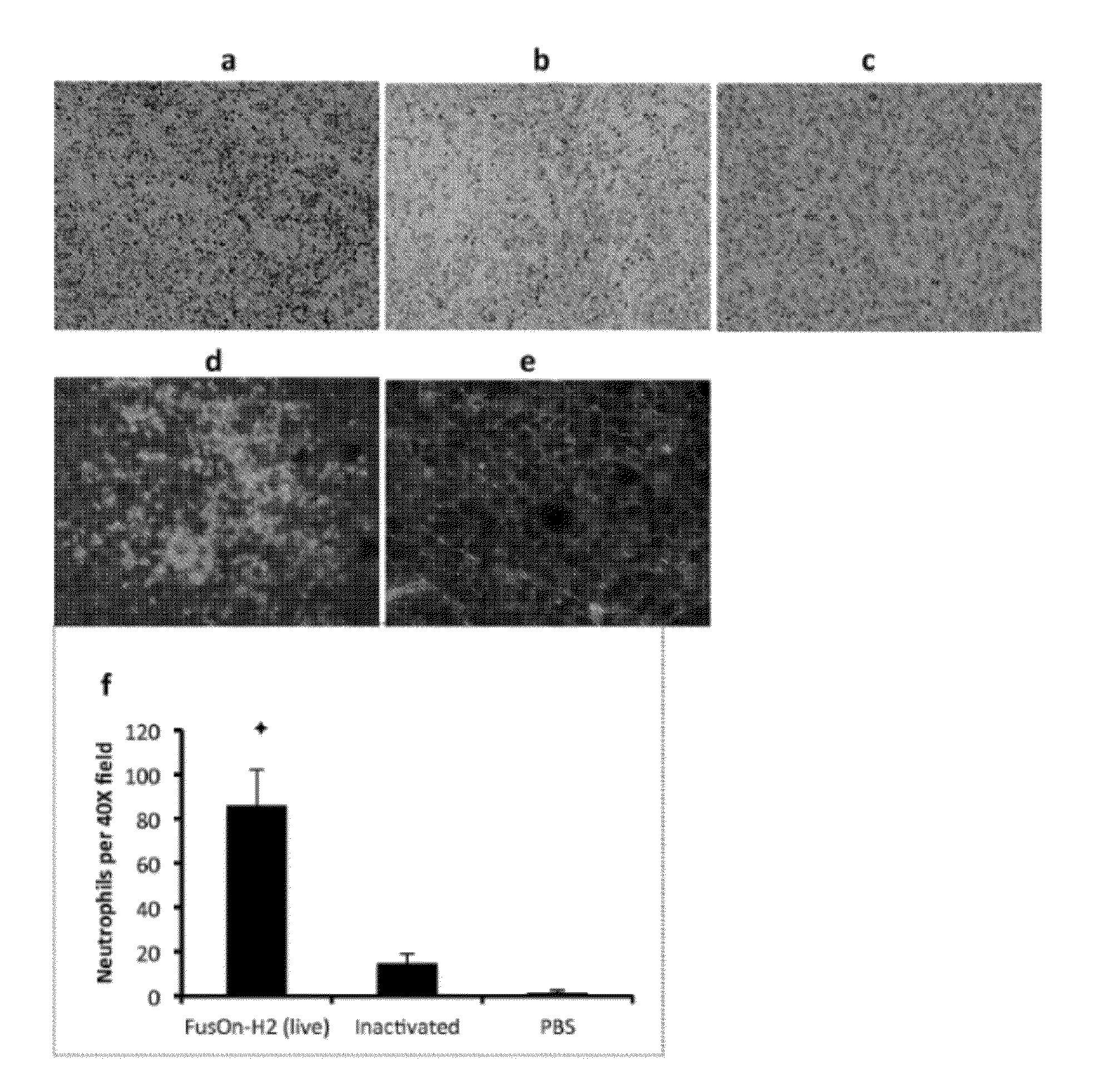 Oncolytic Virus as an Inducer for Innate Antitumor Immunity