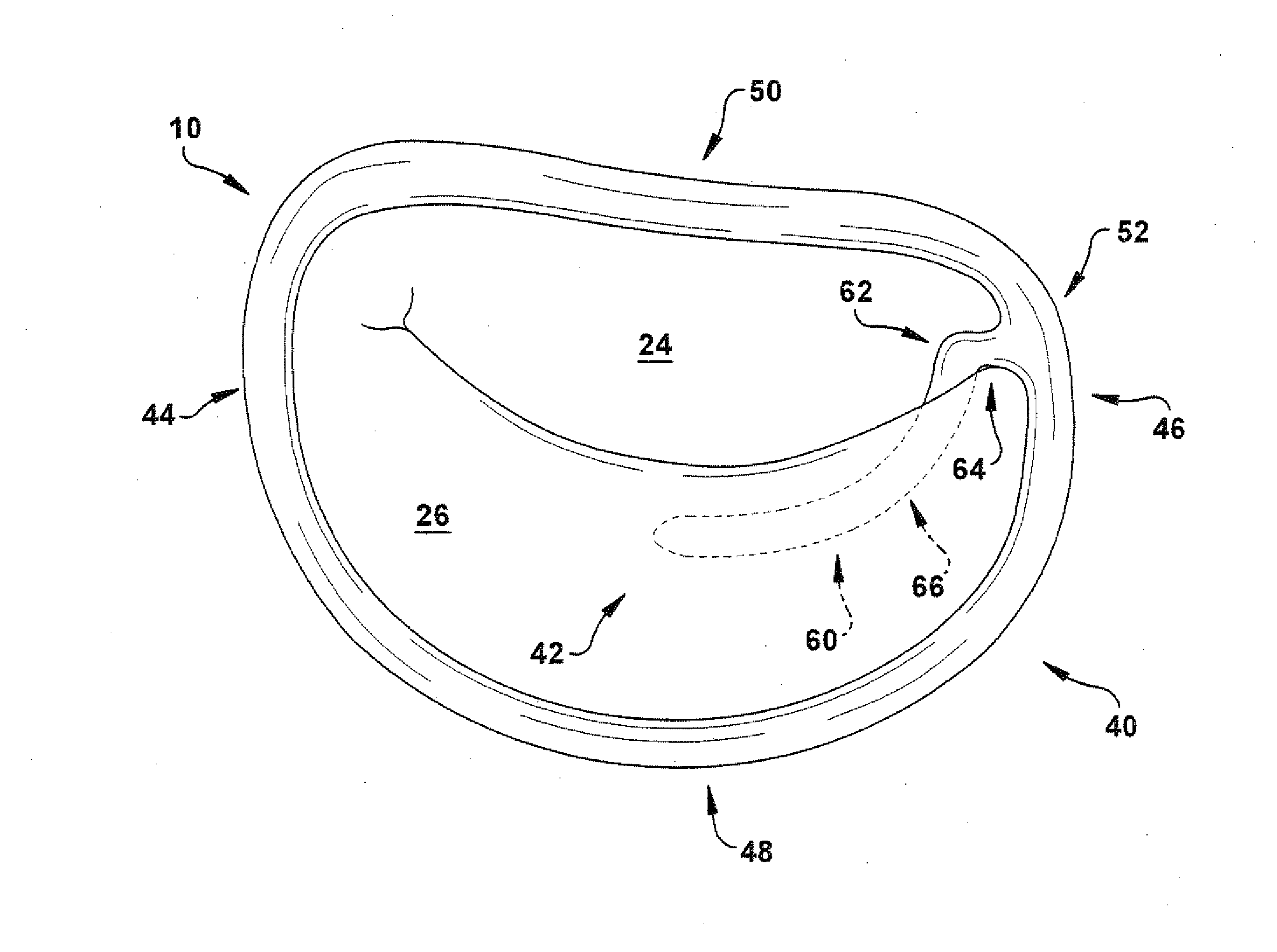 Apparatus and method for treating a regurgitant heart valve