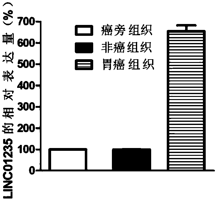 Gastric cancer related biomarker and application thereof