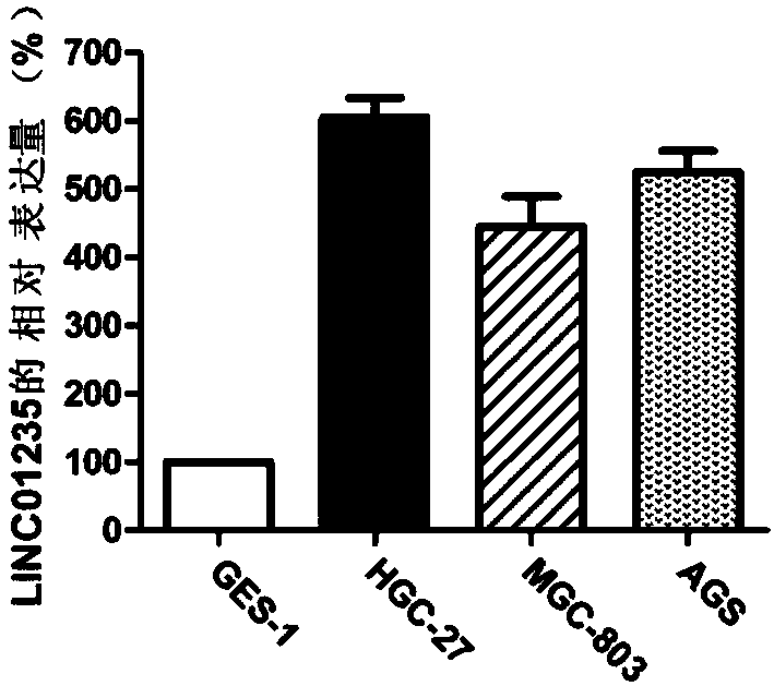 Gastric cancer related biomarker and application thereof