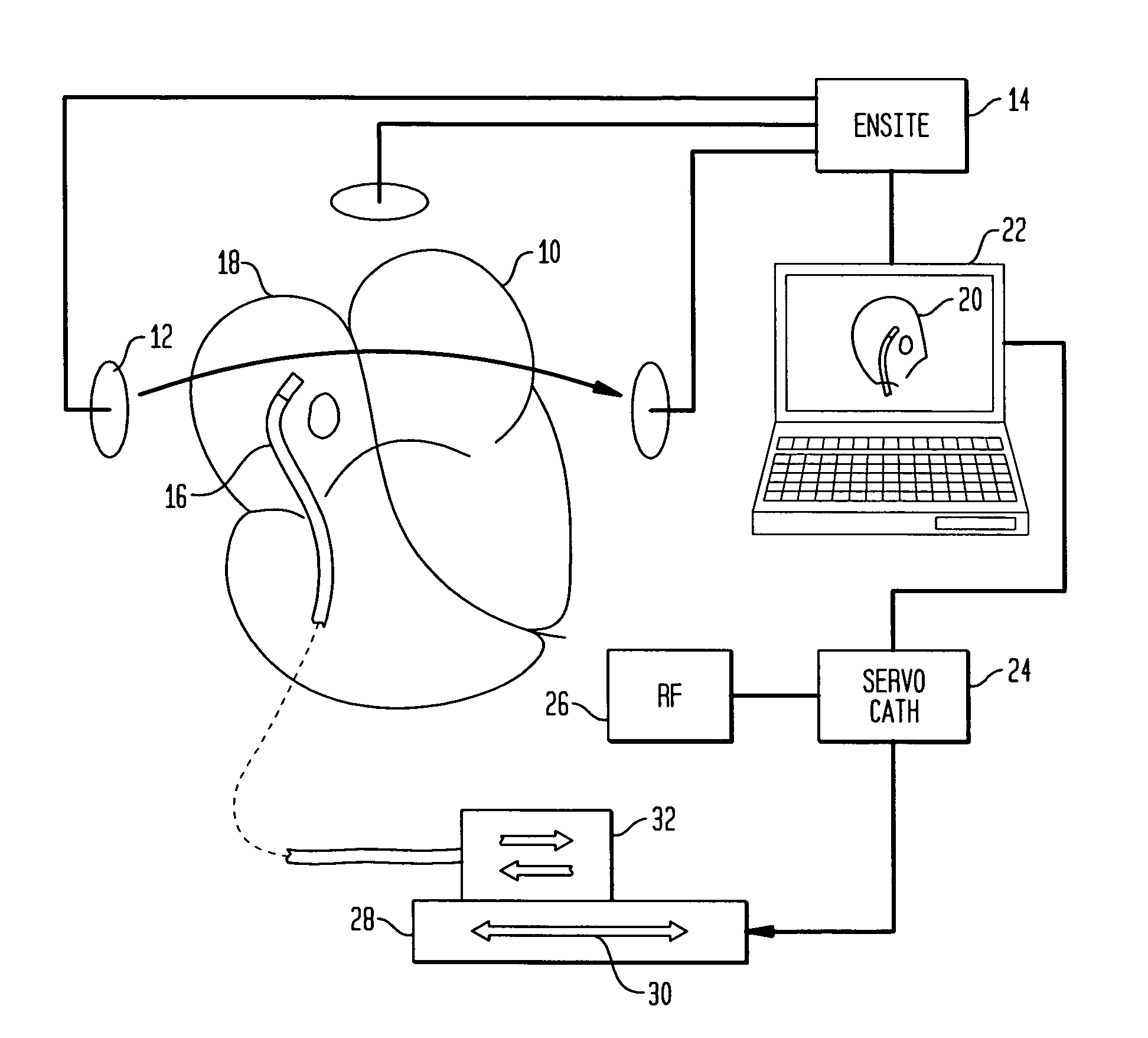 Radio frequency ablation servo catheter and method