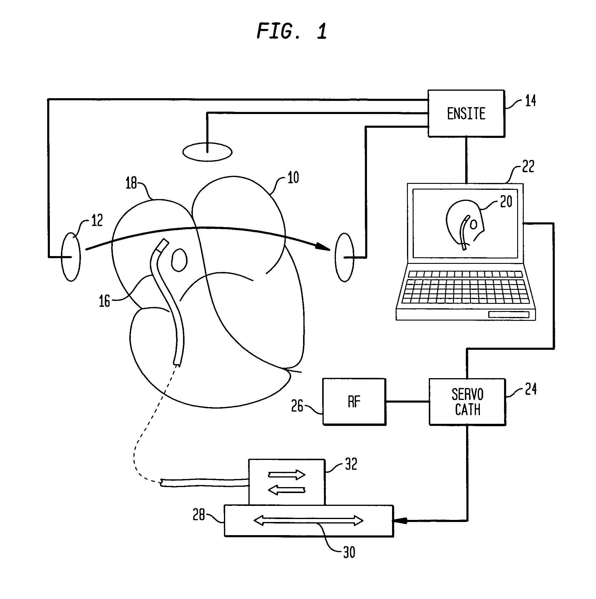 Radio frequency ablation servo catheter and method