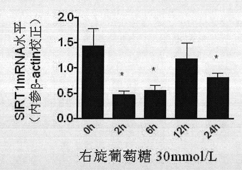 Use of SIRT1 in preparation of drugs for prevention of diseases caused by endothelial dysfunction