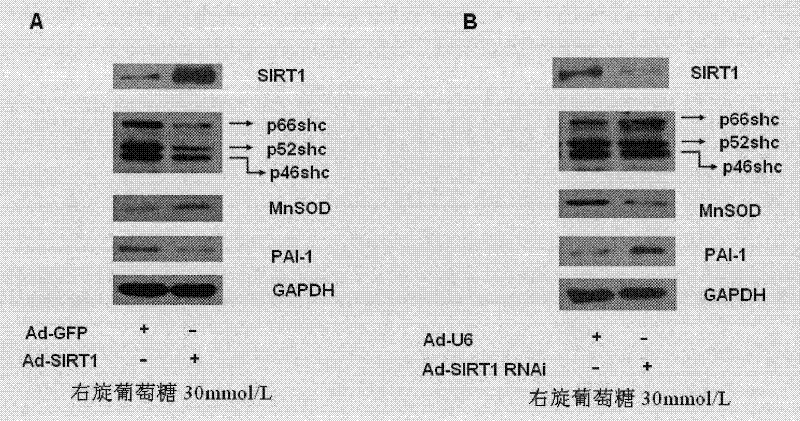 Use of SIRT1 in preparation of drugs for prevention of diseases caused by endothelial dysfunction