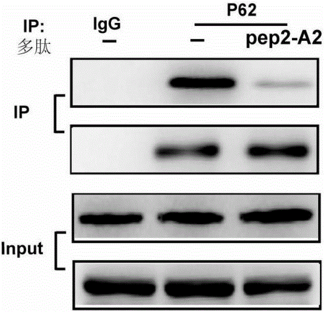 Application of polypeptide or its derivative in prevention and/or treatment of hypertensive myocardial hypertrophy