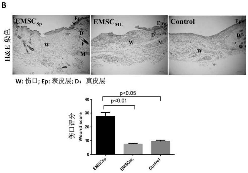 A kind of stem cell ointment for treating skin damage and preparation method thereof