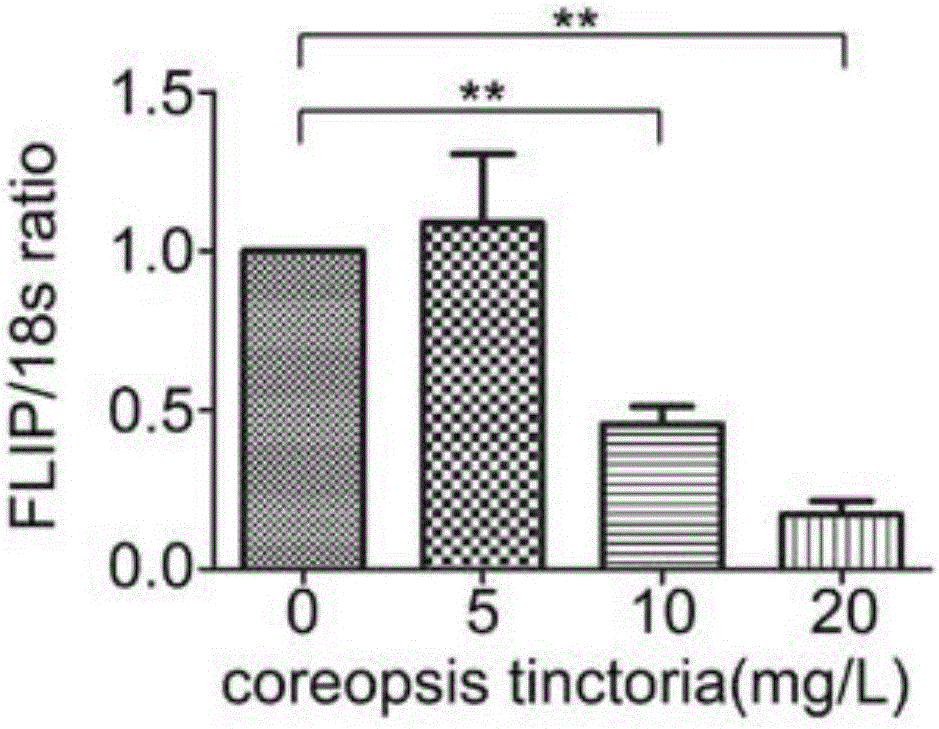 Application of snow chrysanthemum extract and snow chrysanthemum total flavone in preparation of drug for treating hepatic fibrosis