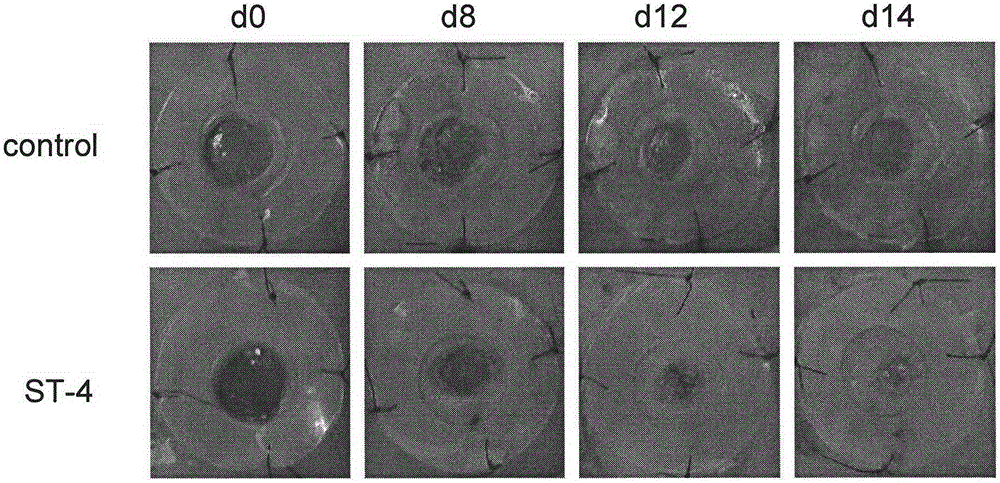 Medical application of notoginsenoside ST-4