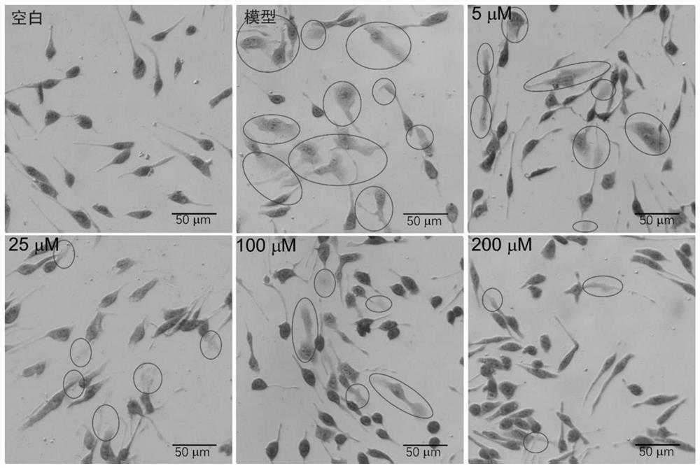 Cage-like monoterpene glycoside compounds derived from radix paeoniae rubra as well as preparation method and application of cage-like monoterpene glycoside compounds