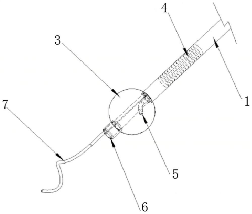 Epicardial ablation system