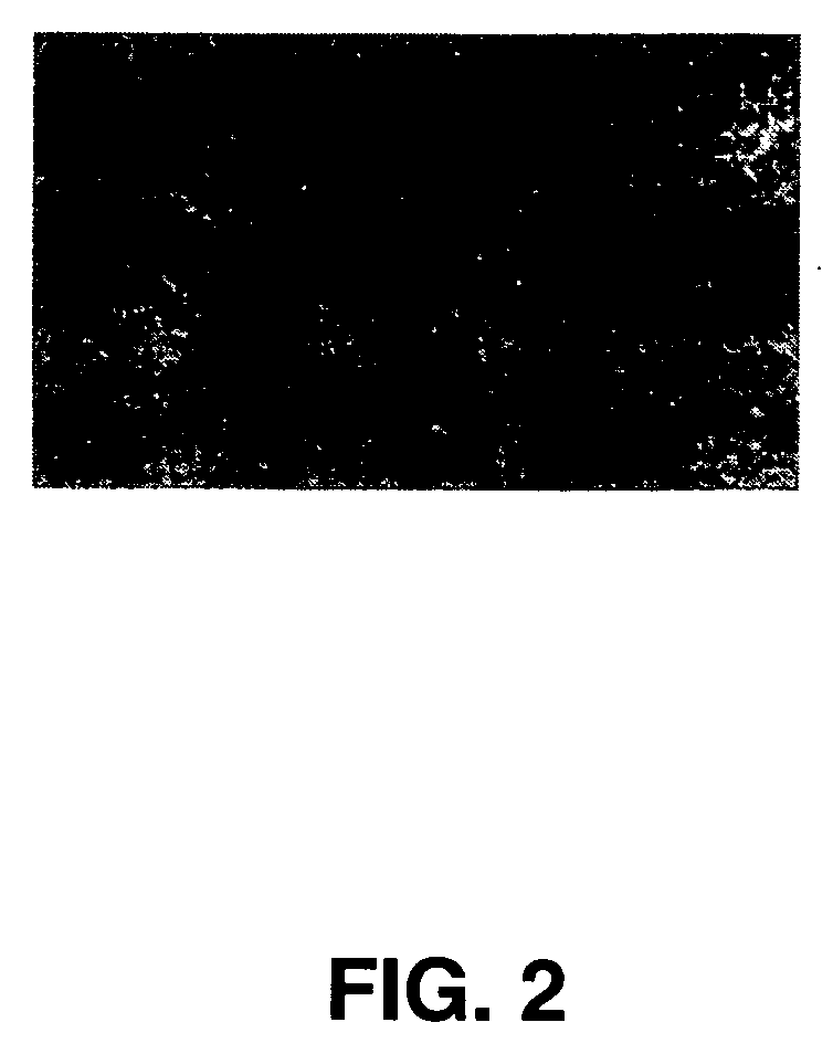 Seneca valley virus based compositions and methods for treating disease