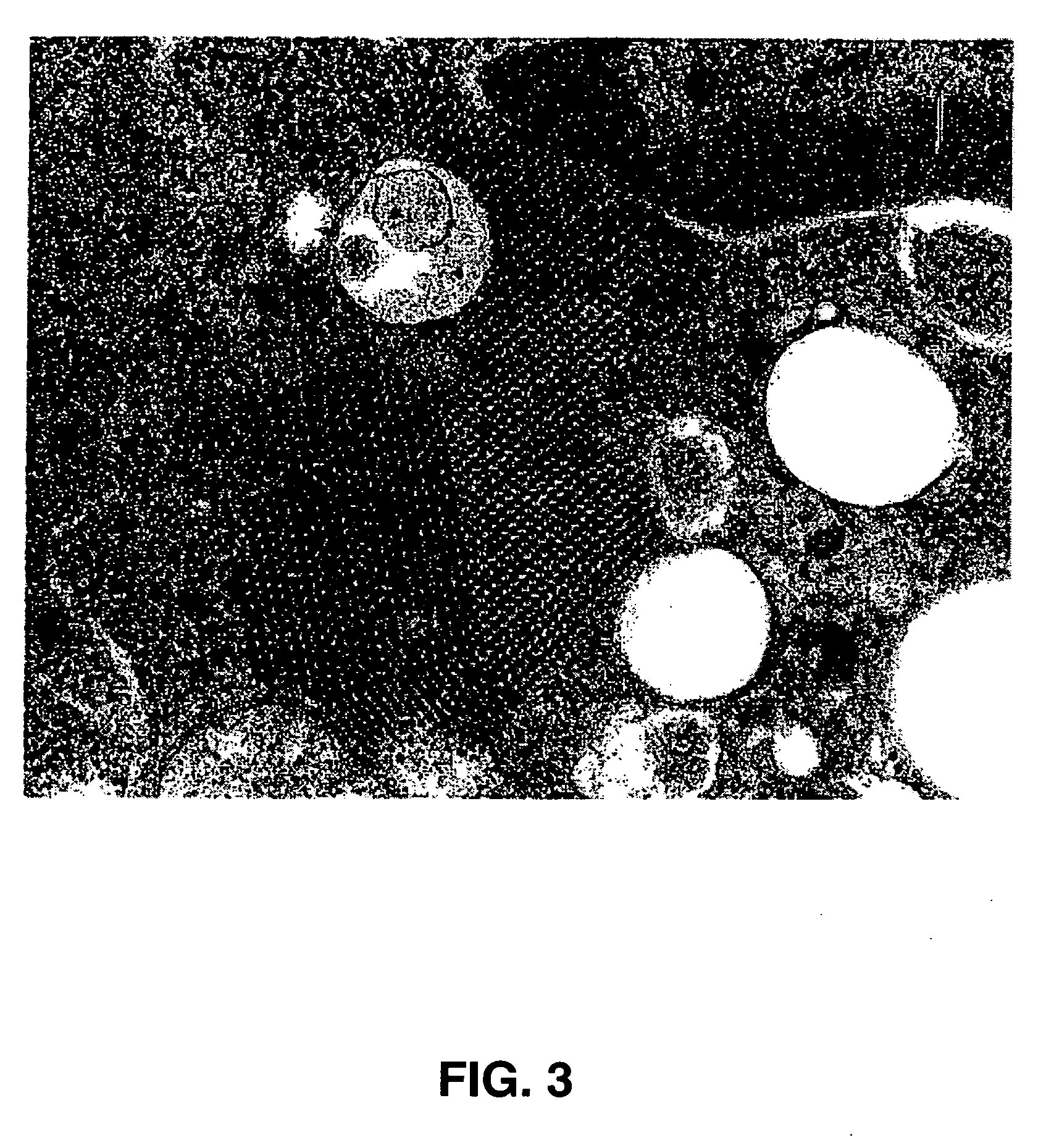 Seneca valley virus based compositions and methods for treating disease