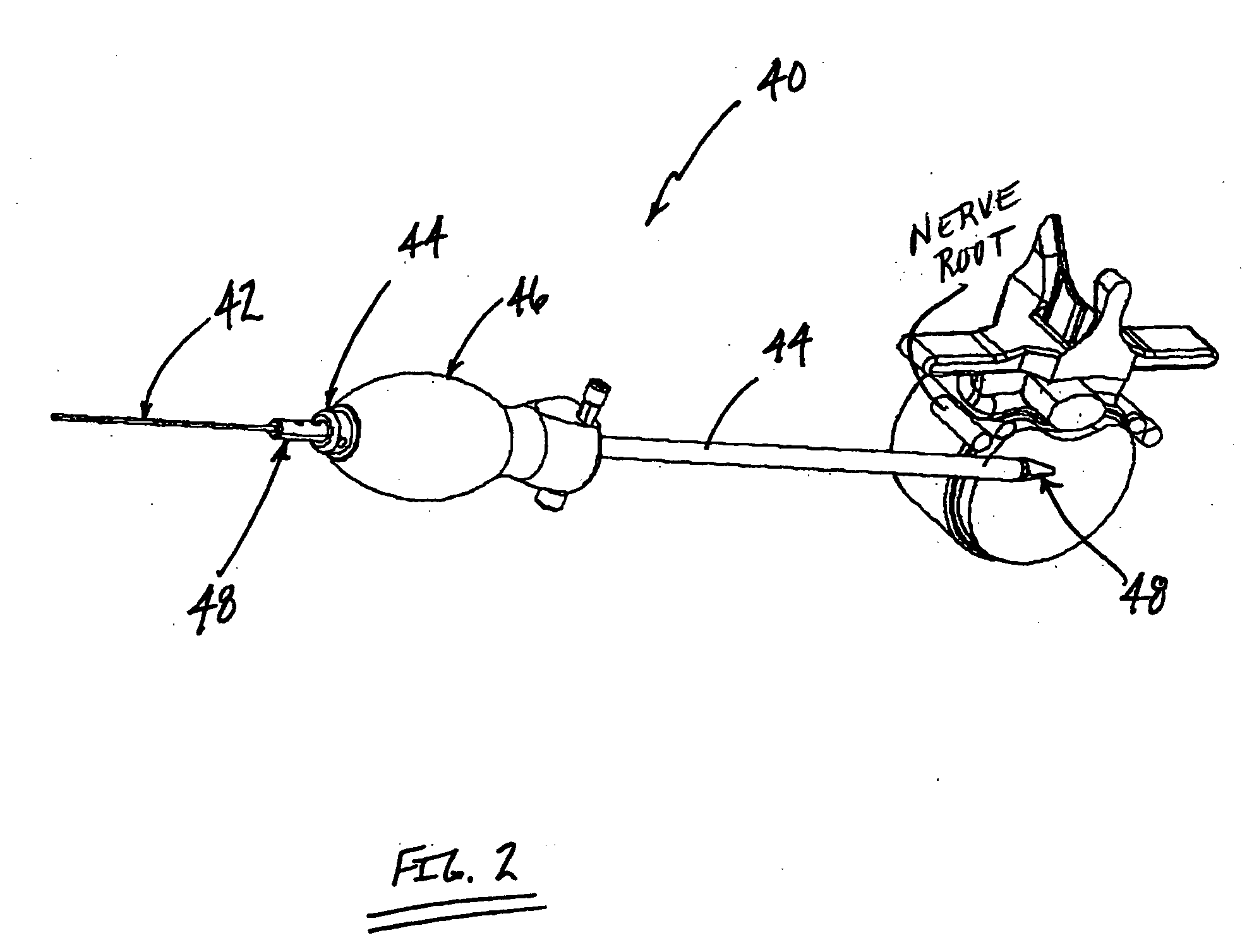 Surgical access system and related methods