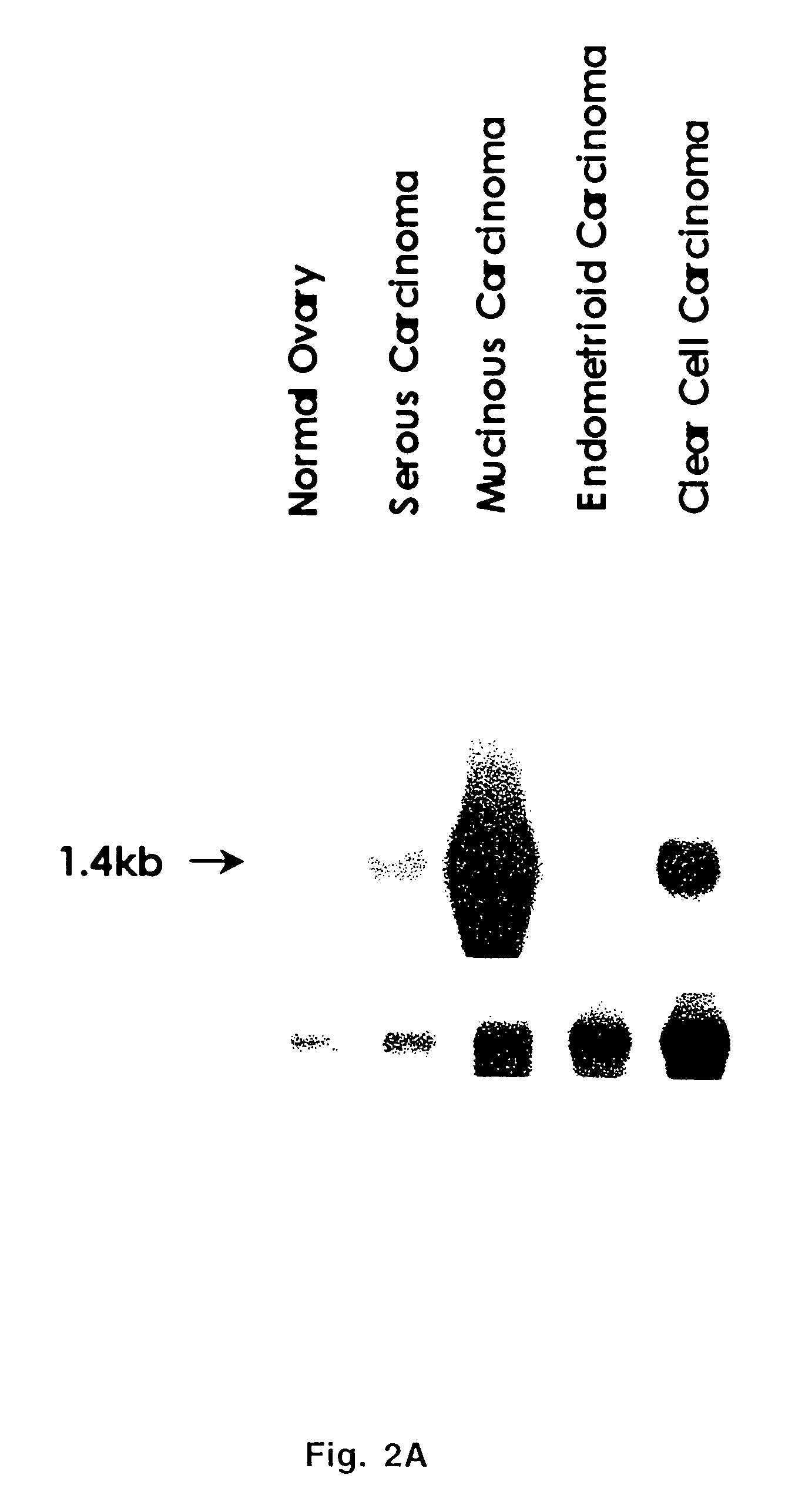 Extracellular serine protease