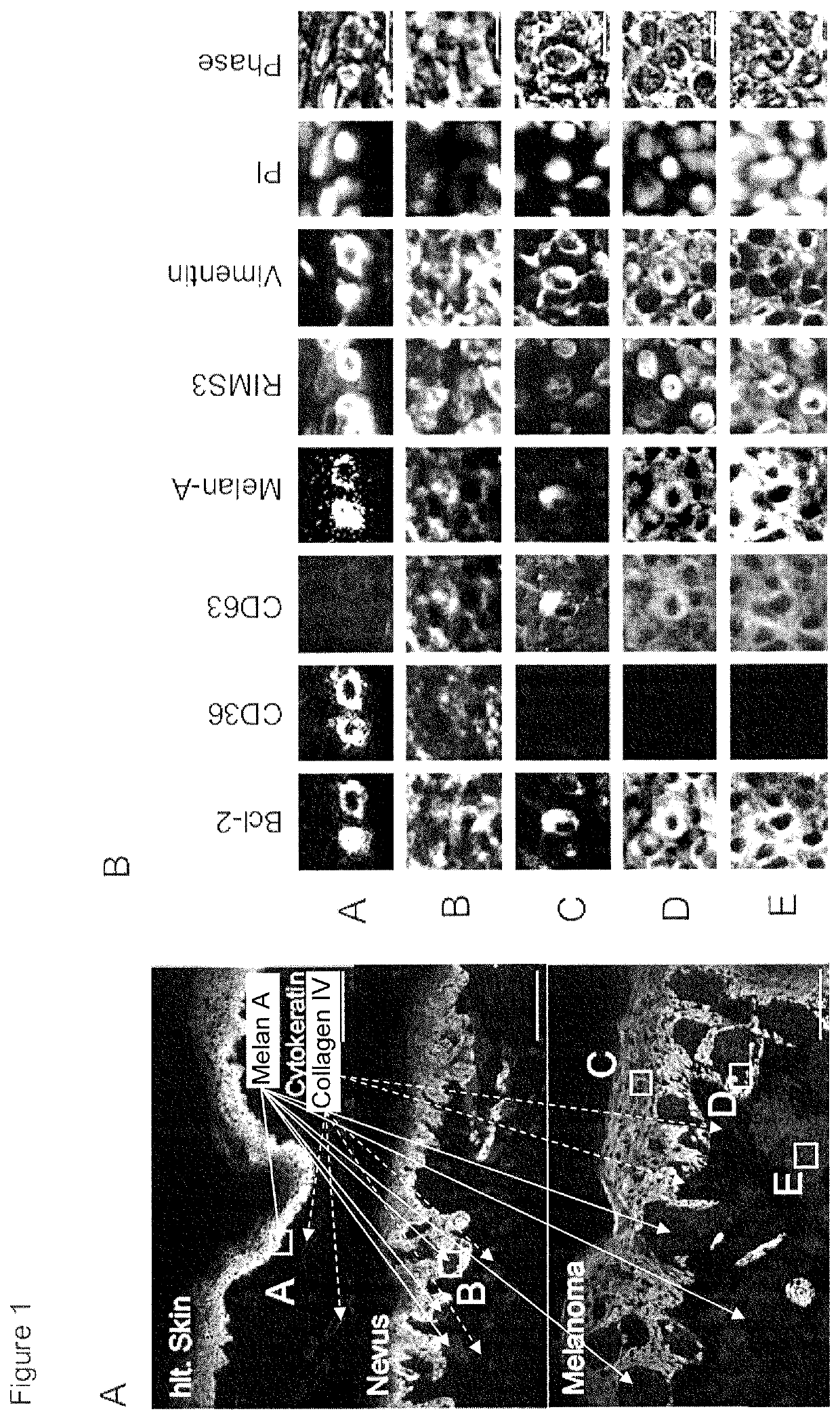 A method for characterizing melanocytic lesions