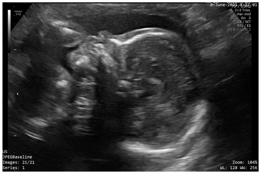 Method for intelligently acquiring bone structure parameters of fetal face and terminal equipment