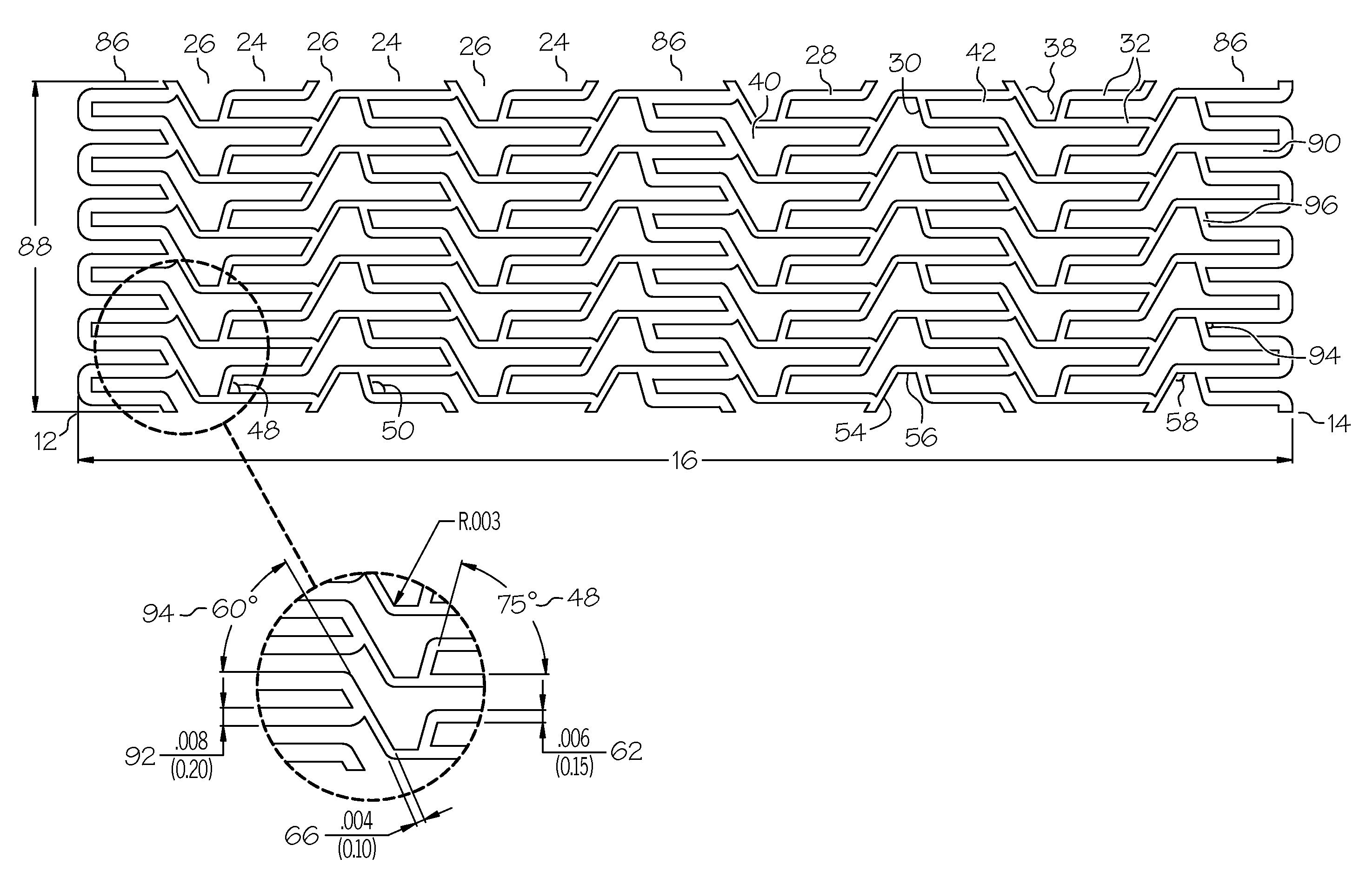 Intravascular stent