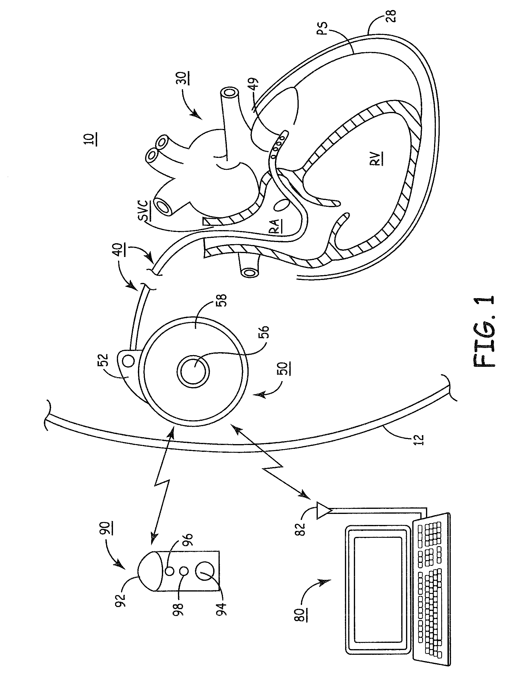 Methods and systems for providing therapies into the pericardial space