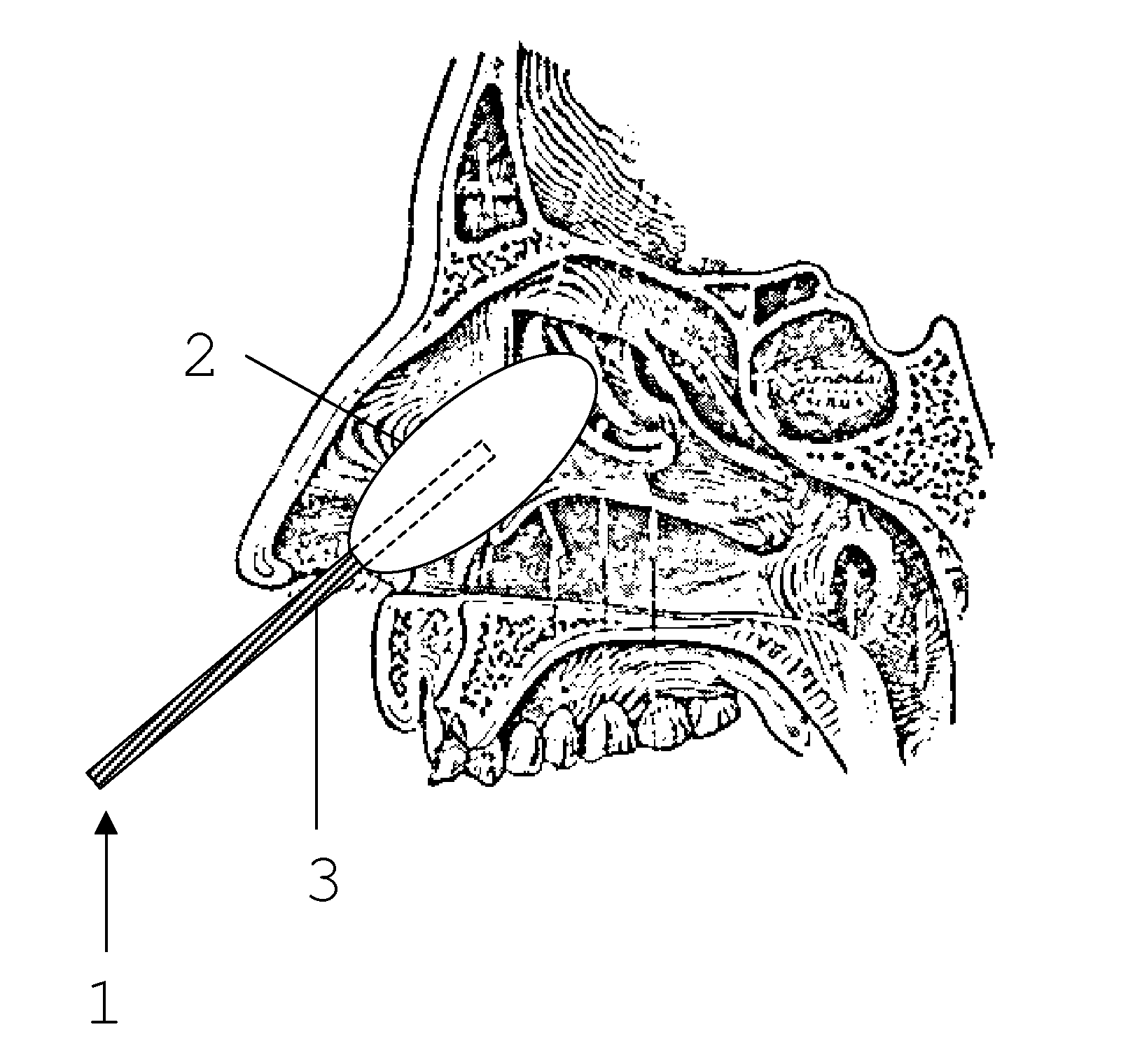 Vibration device