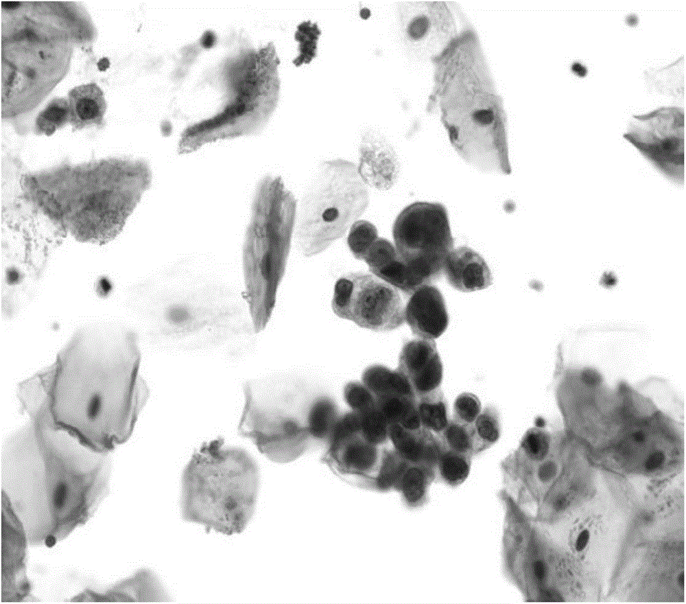 A kind of sputum cell treatment liquid and its application