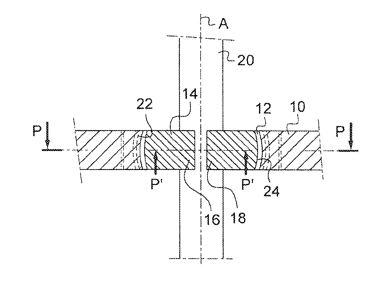 Osteosynthesis Device With Rapid Fixing Means