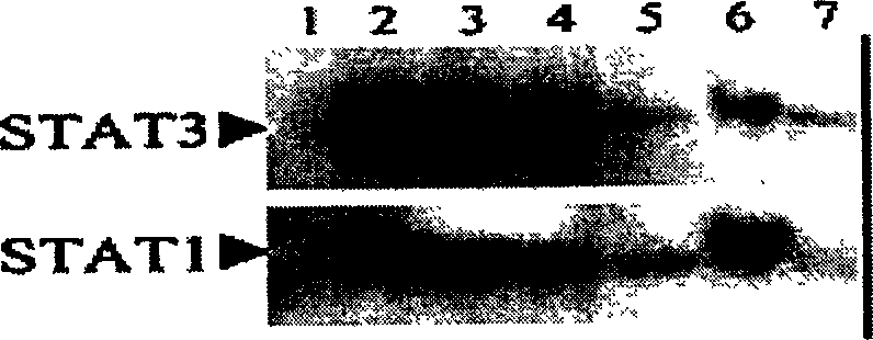 Method for measuring T-cell membrane fat micro domain STAT 5a and STAT 5b distribution and uses thereof