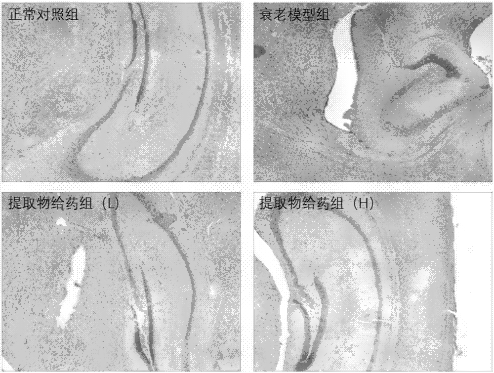 Application of aronia melanocarpa fruit extract in preparing anti-aging drug