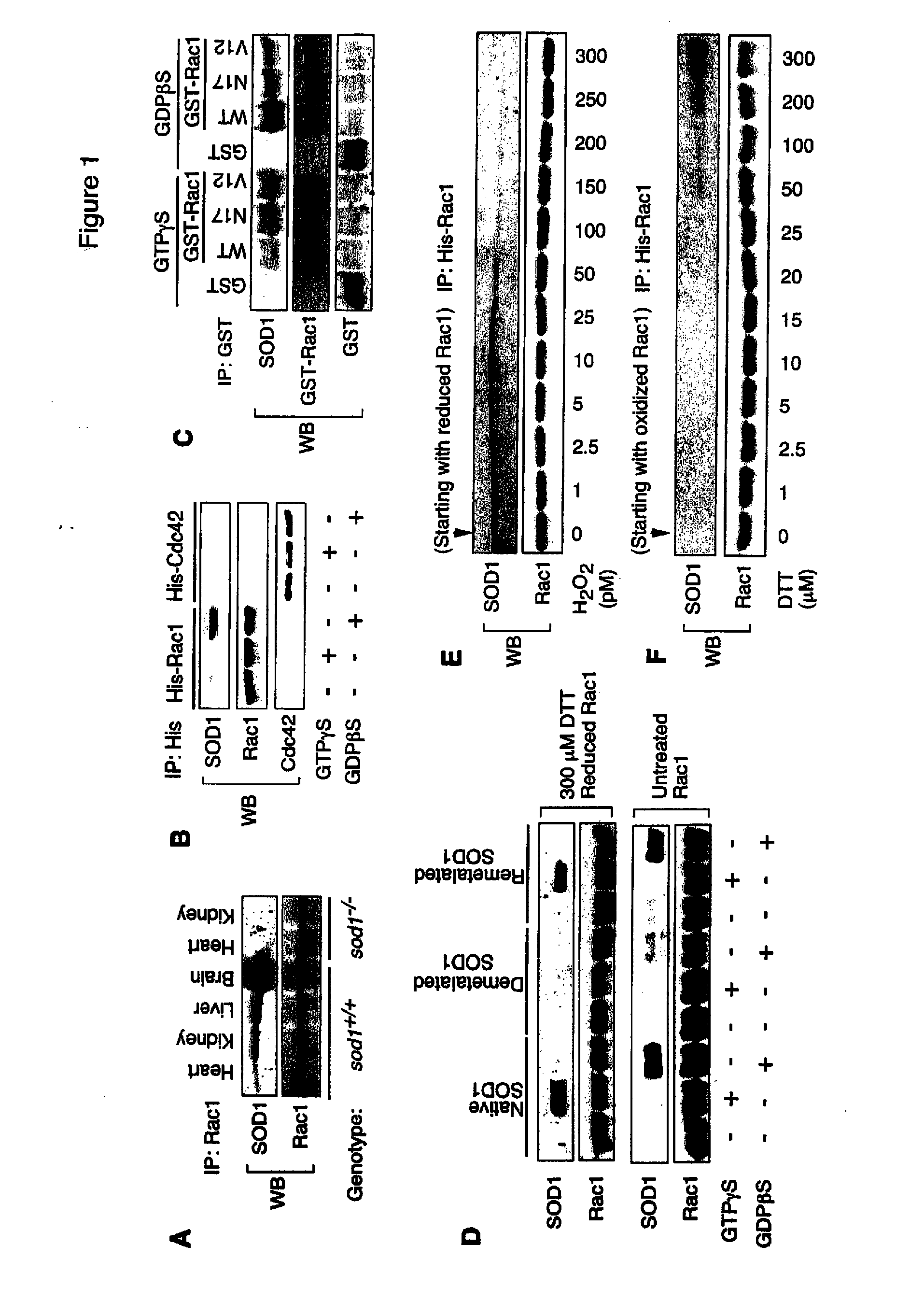 Method of identifying compounds useful to treat neuronal degenerative diseases