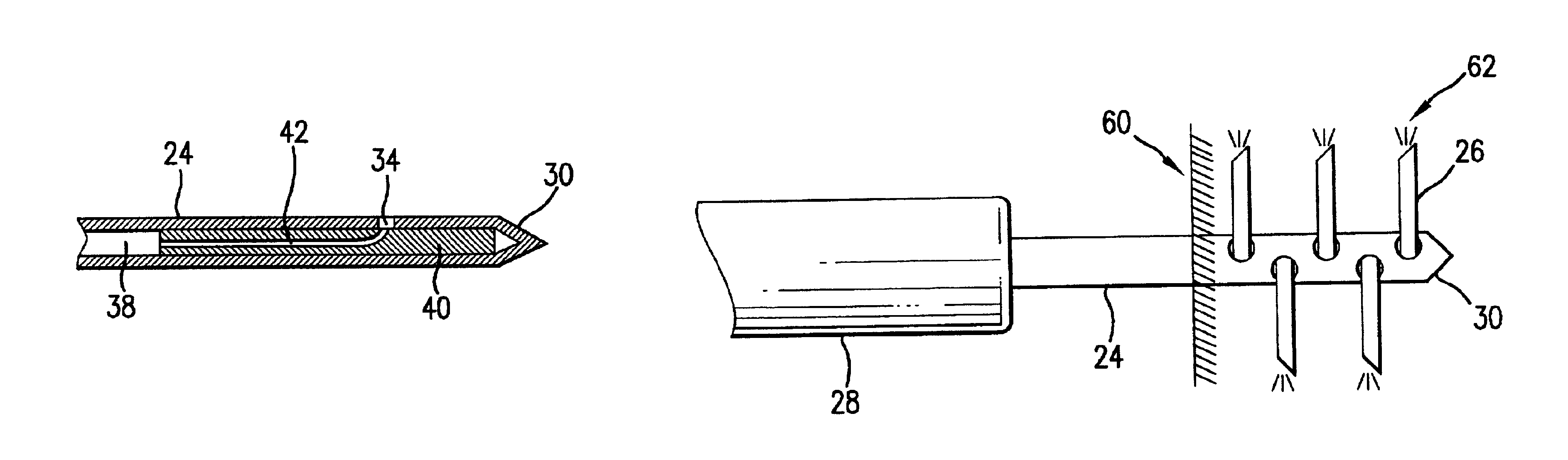 Lateral needle injection apparatus and method