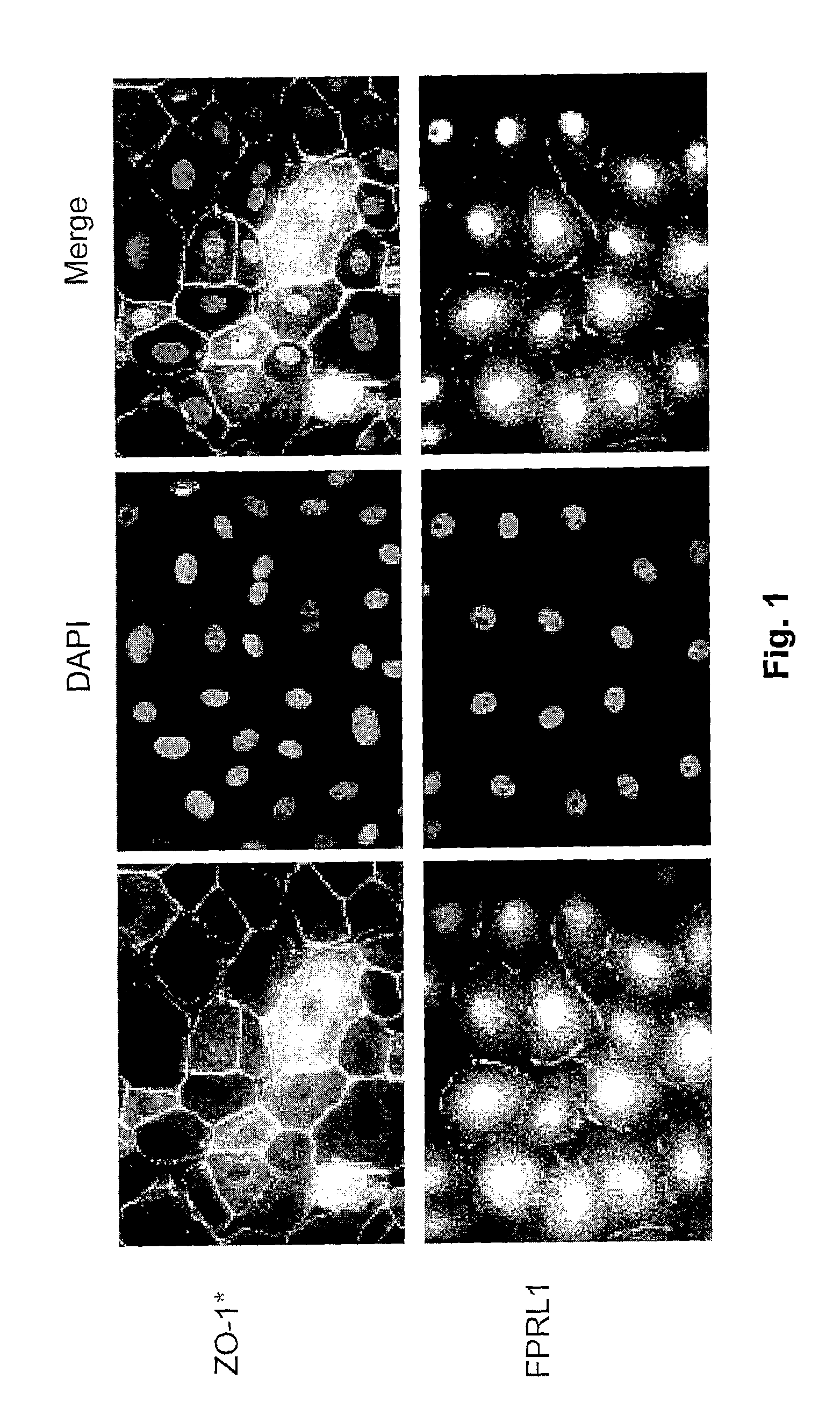 Lipoxin A4 protection for cornea endothelial cells